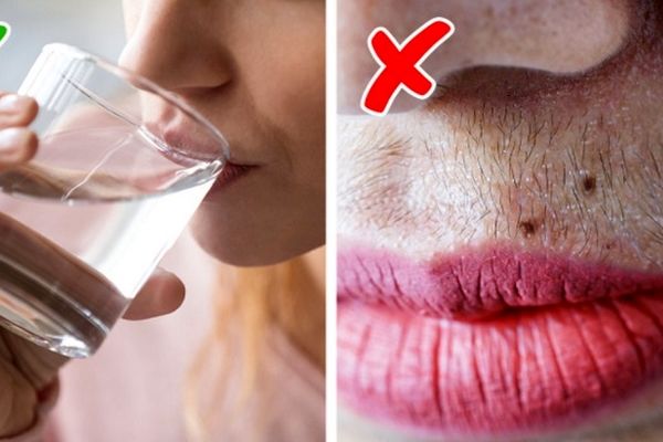 برای جلوگیری از رشد موهای زاید چه راهکارهایی میتوان کرد 