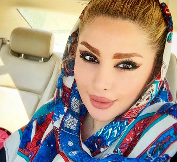 قیافه وحشتناک دنیا جهانبخت بدون آرایش | خوب شد کلی عمل کرد !