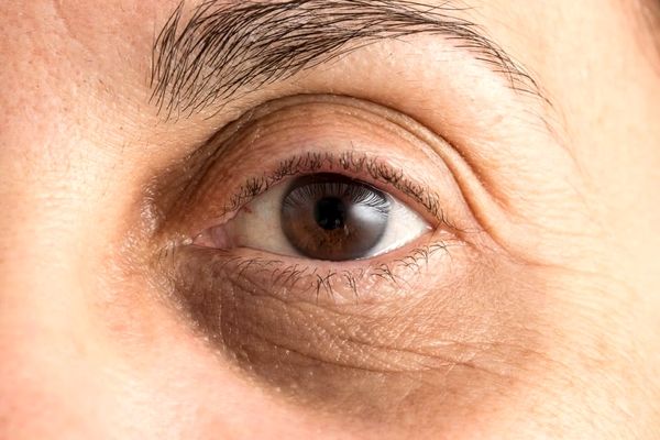 با این ترفندها در آرایش گودی چشمتان را بپوشانید 