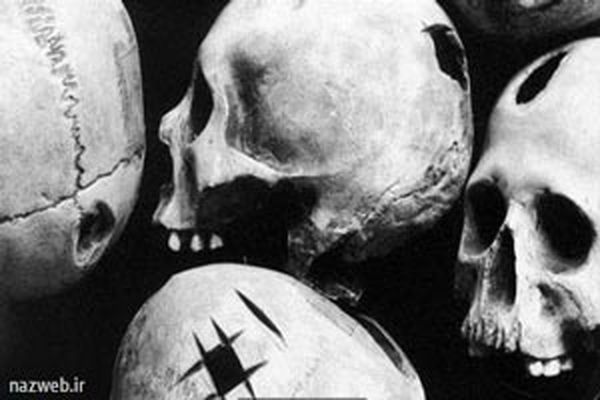 چرا در گذشته جمجمه آدم ها را سوراخ میکردند؟ تصاویر 18+ 
