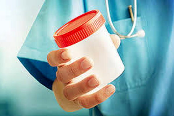 با خوردن این خوراکی ها اسپرم را بارور کنید | آقایان این خوراکی ها را بخورند 