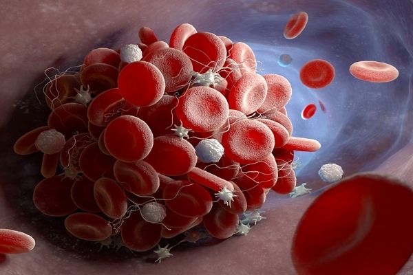 تاثیراتی که سفر به فضا بر جریان خون فضانوردان می‌گذارد