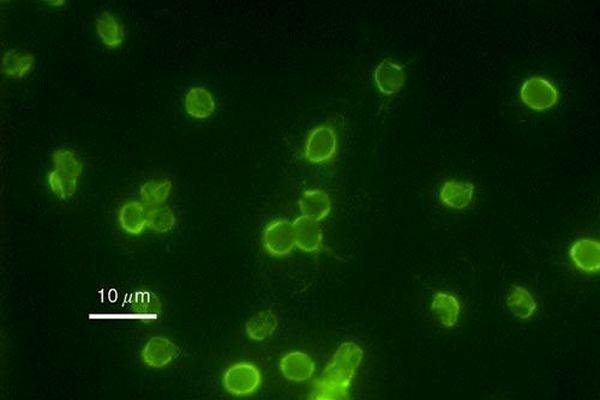 وحشتناک ترین موجوات پنهان در یک لیوان آب
