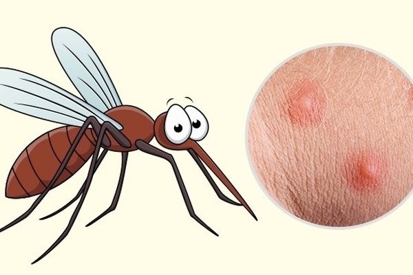 راهکاری برای خلاص شدن از نیش حشرات 