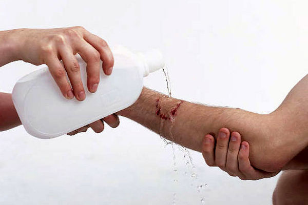 ترمیم زخم های روی پوست چگونه است؟ + ویدئو