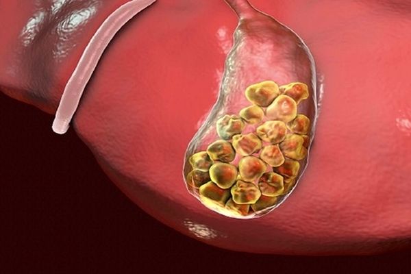 بهترین سبزیجات برای سلامت کیسه صفرا 