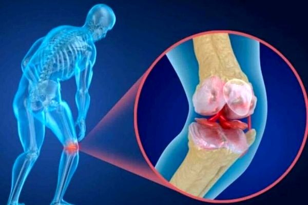 معجون استخوان ساز کسی تا حالا بهت یاد نداده | طرز تهیه معجون استخوان ساز با دو قلم مواد