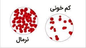 برای درمان کم خونی چی بخوریم؟