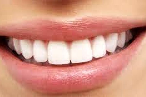 روش های خانگی درمان التهاب لثه | اگه التهاب لثه اذیتت میکنه این روش ها را امتحان کن