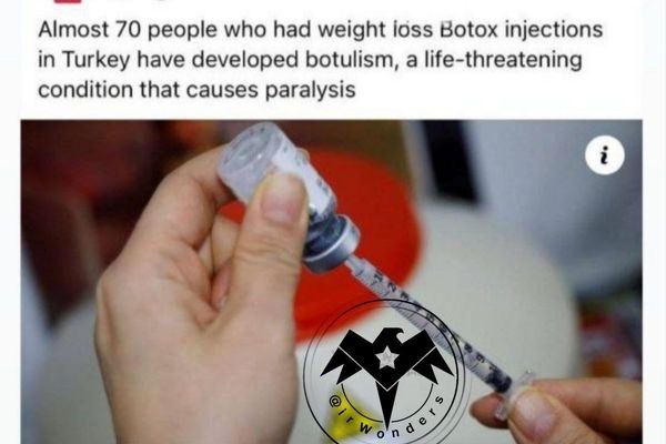 تزریق بوتاکس فاجعه آور شد | تزریق بوتاکس برای لاغری ۷۰ نفر را فلج کرد!