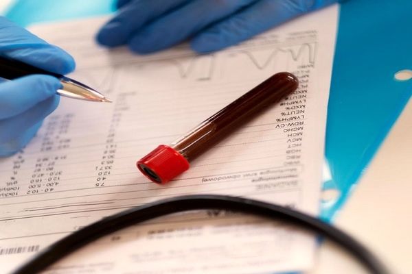 تشخیص سرطان پوست با آزمایش خون